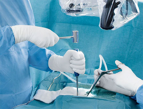 Leica-M530-OHX-Surgeon-Workflow-efficiency-redefined